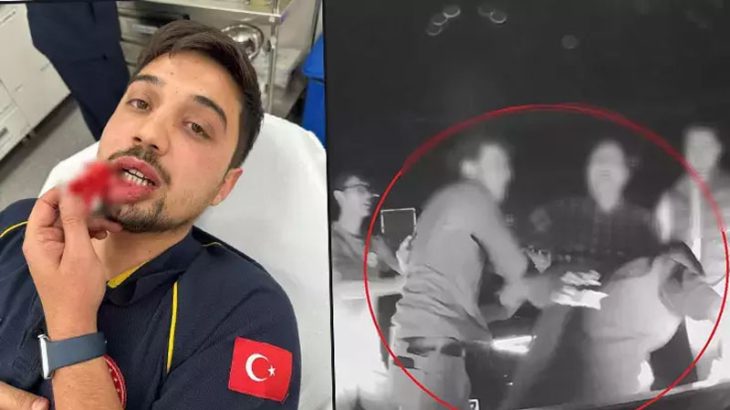 Baba ile oğlu, kalp krizi geçiren hastayı taşıyan ambulansın önünü kesti! Sürücüye tekme tokat saldırdılar